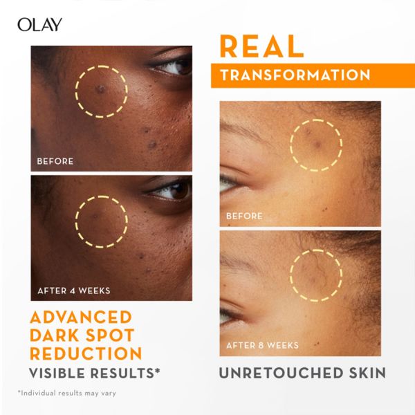 Olay Vitamin C Kit for 2X Glow – Serum + Cleanser